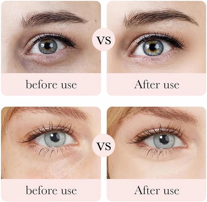 Contorno de ojos Rose hyalutonic